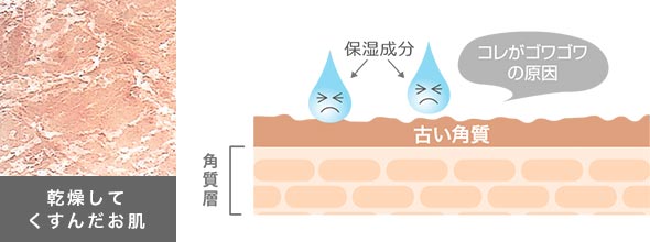 乾燥してくすんだお肌