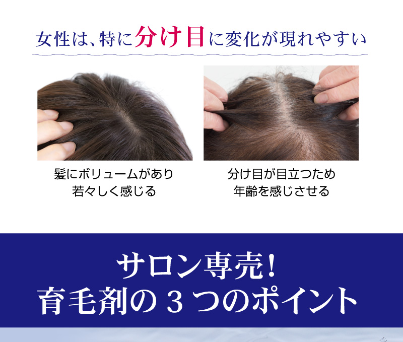 女性は、特に分け目に変化が現れやすい