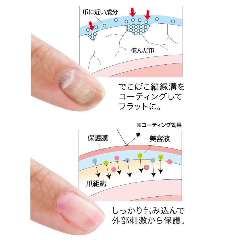 補修のイメージ