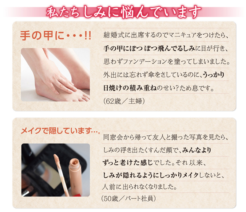 私たちしみに悩んでいます