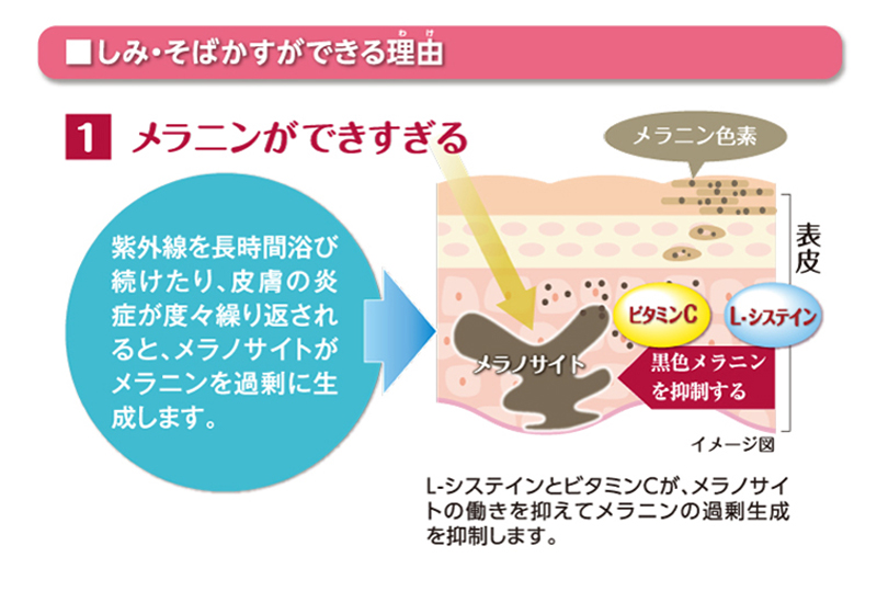 しみ・そばかすができる理由 1.メラニンができすぎる