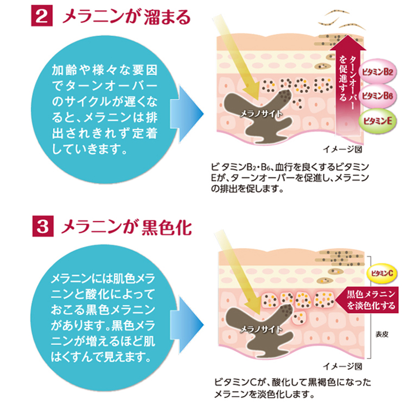 2.メラニンが溜まる 3.メラニンが黒色化