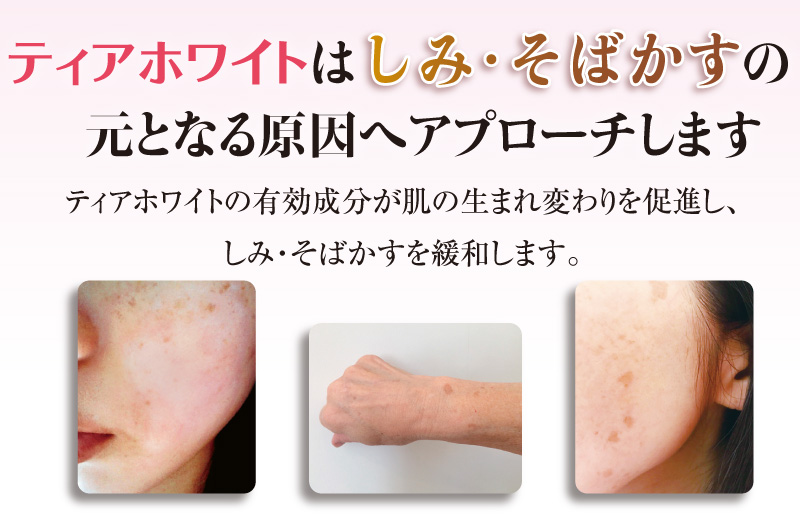 ティアホワイトはしみ・そばかすの元となる原因にアプローチします
